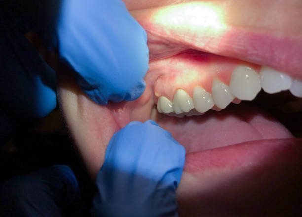 Best Broken or Cracked Tooth Emergency Dentist in Reynoldsville, PA