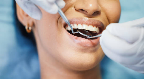 Best Emergency Dental Extractions in Reynoldsville, PA
