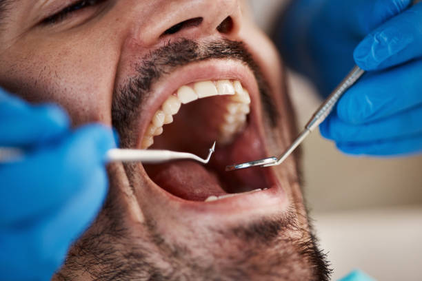 Best Emergency Dental Care for Abscessed Tooth in Reynoldsville, PA