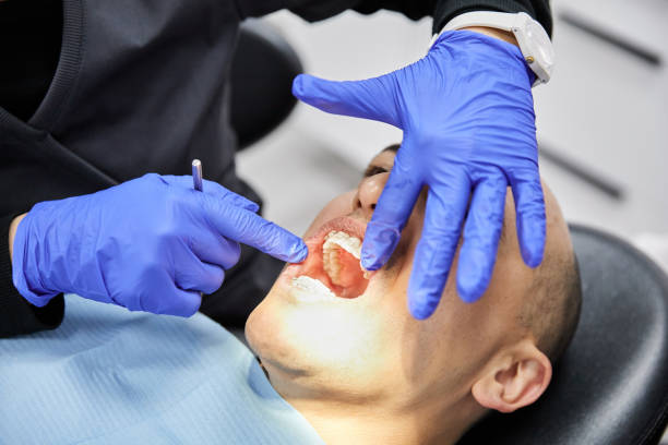 Best Emergency Dentist for Lost Fillings or Crowns in Reynoldsville, PA